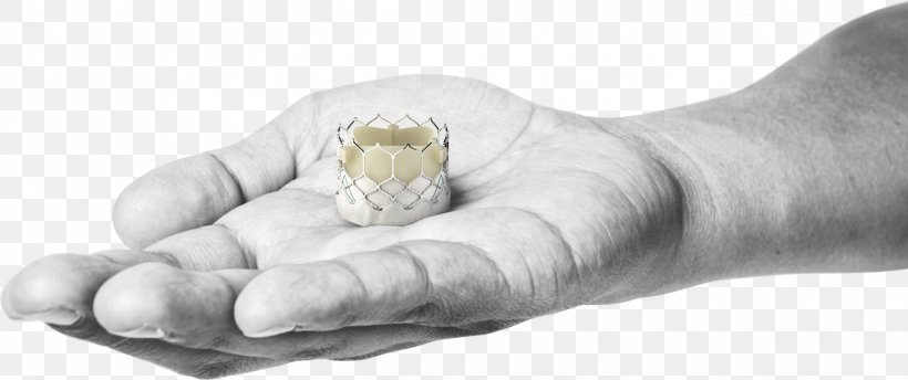 percutaneous aortic valve replacement edwards lifesciences heart valve aortic stenosis png favpng dVpRyvkMQwMB53r4Ky1QLfbQY
